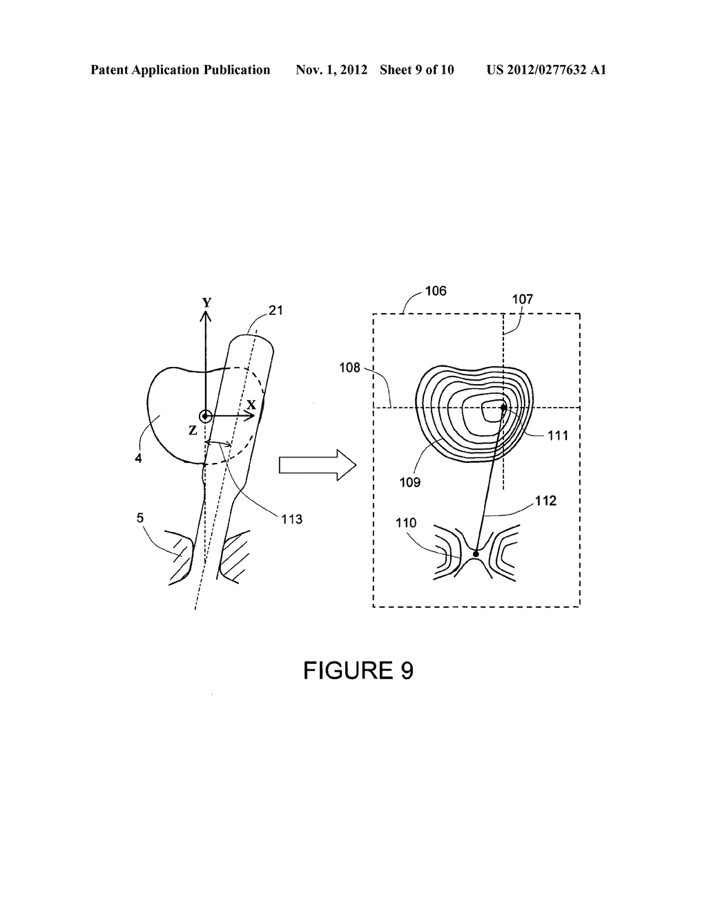 METHOD AND A DUAL-ARRAY TRANSDUCER PROBE FOR REAL TIME MECHANICAL IMAGING     OF PROSTATE - diagram, schematic, and image 10