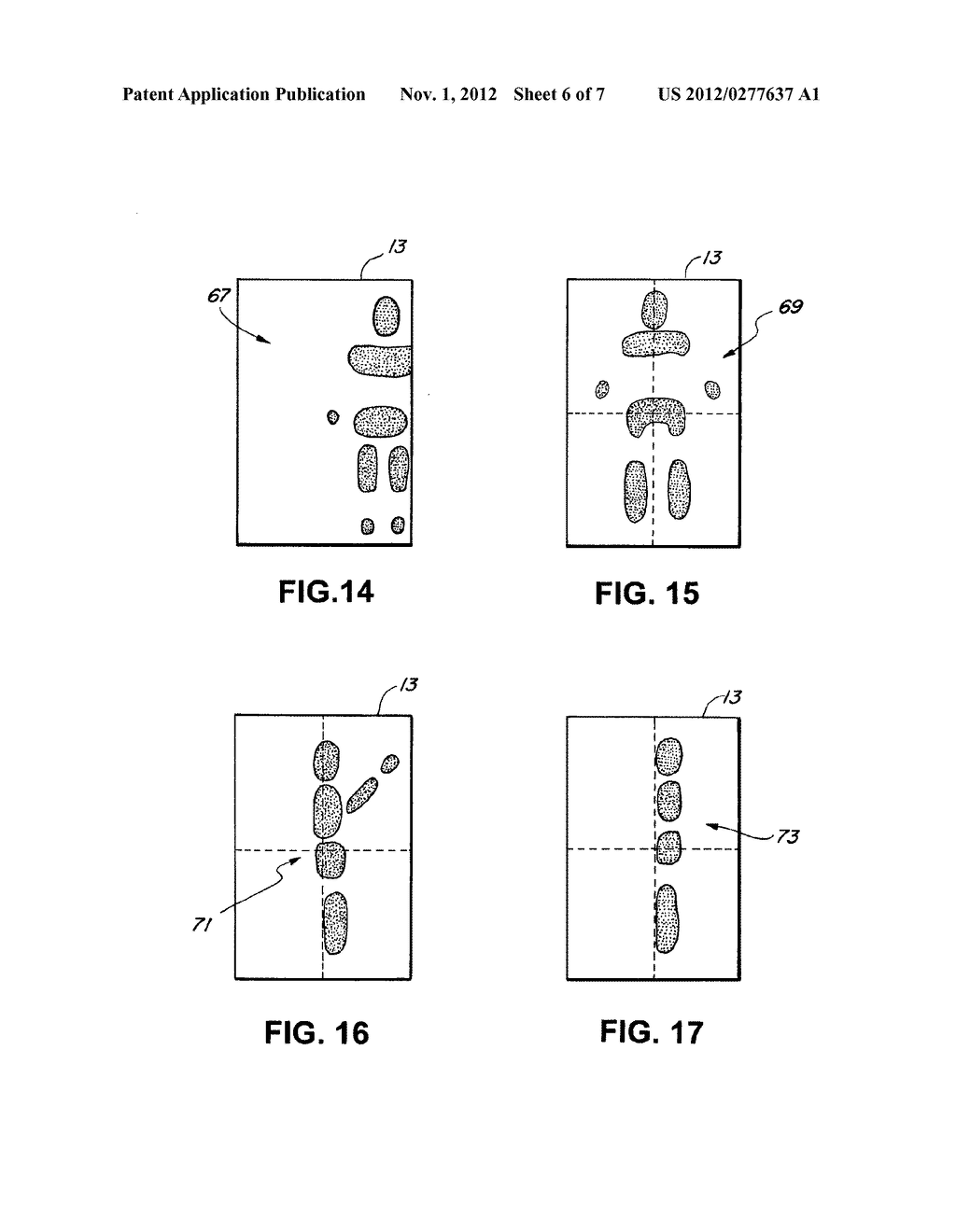 Method And System For Monitoring Pressure Areas On A Supported Body - diagram, schematic, and image 07