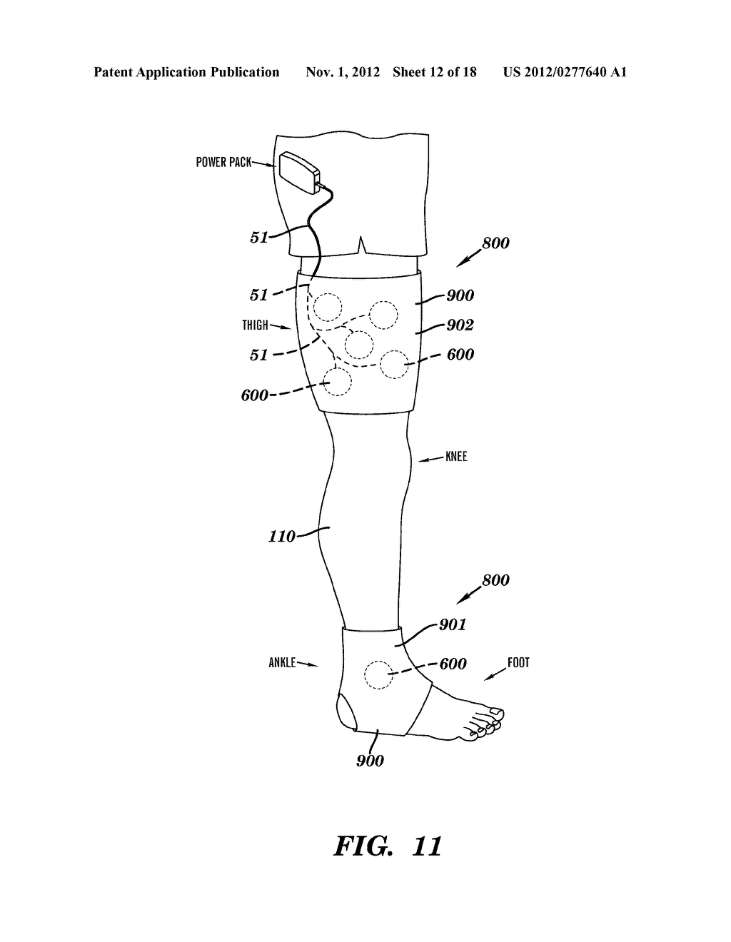 ULTRASOUND COUPLING DEVICE - diagram, schematic, and image 13