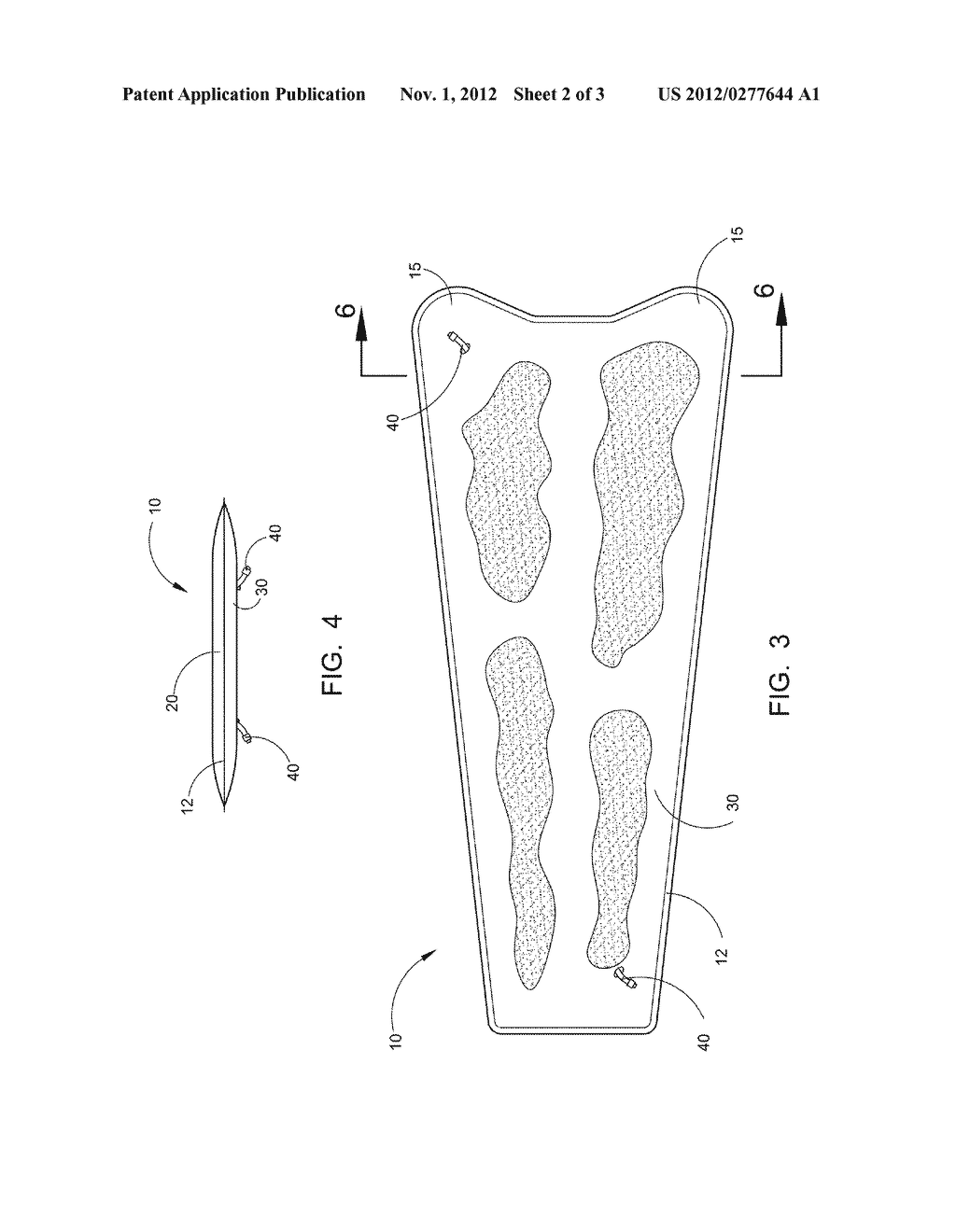 Vacuum Splint - diagram, schematic, and image 03