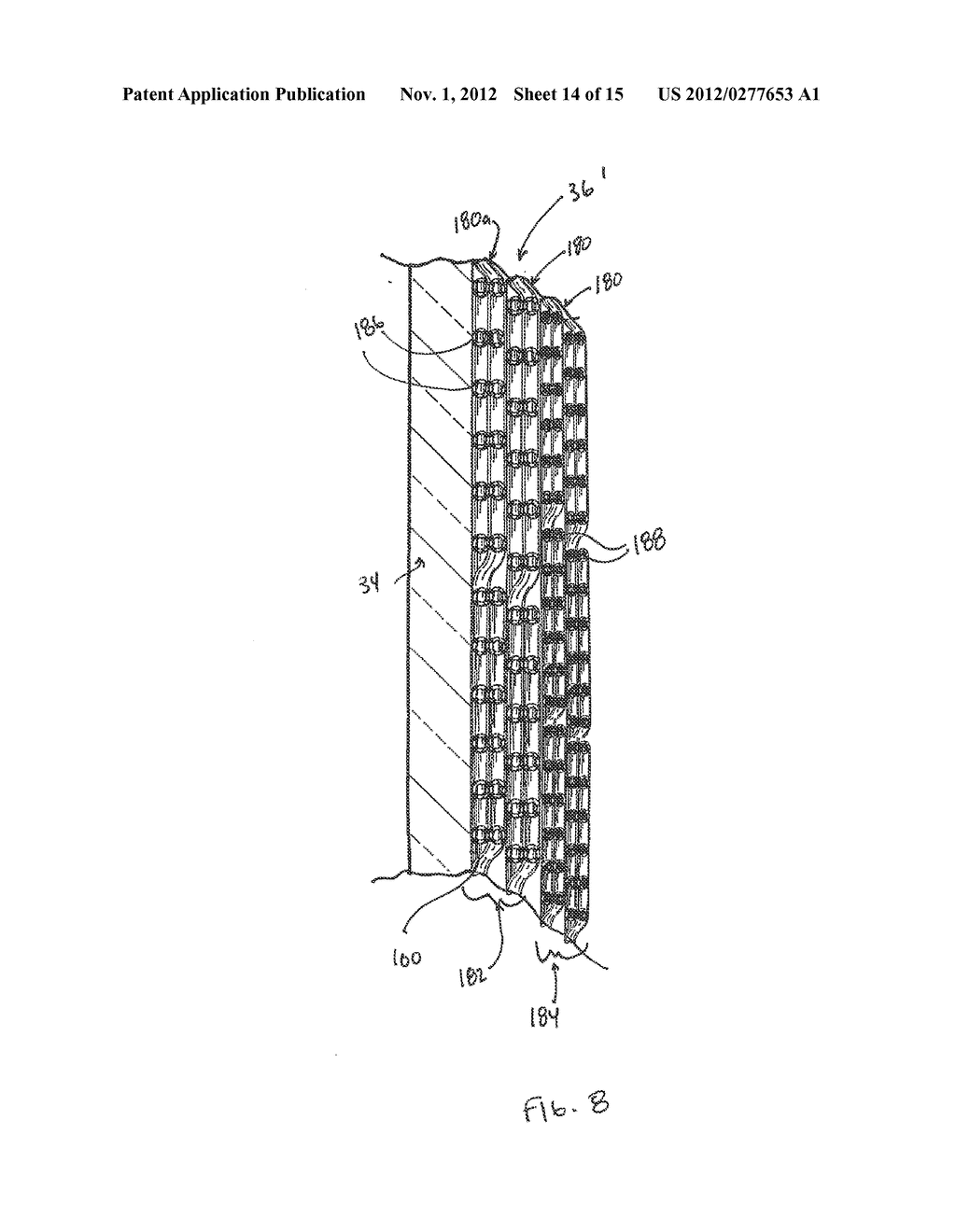 Combination Oxygenator and Arterial Filter Device With A Fiber Bundle of     Continuously Wound Hollow Fibers for Treating Blood in an ExtraCorporeal     Blood Circuit - diagram, schematic, and image 15