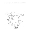 Combination Oxygenator and Arterial Filter Device for Treating Blood in an     ExtraCorporeal Blood Circuit diagram and image