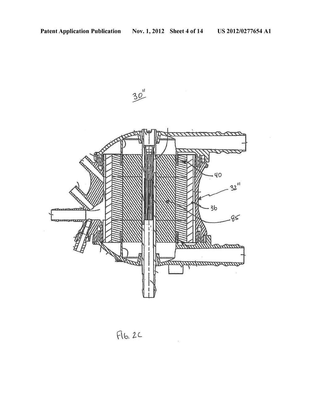 Combination Oxygenator and Arterial Filter Device for Treating Blood in an     ExtraCorporeal Blood Circuit - diagram, schematic, and image 05