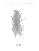 Combination Oxygenator and Arterial Filter Device for Treating Blood in an     ExtraCorporeal Blood Circuit diagram and image