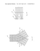 Combination Oxygenator and Arterial Filter Device for Treating Blood in an     ExtraCorporeal Blood Circuit diagram and image