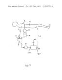 Combination Oxygenator and Arterial Filter Device for Treating Blood in an     ExtraCorporeal Blood Circuit diagram and image