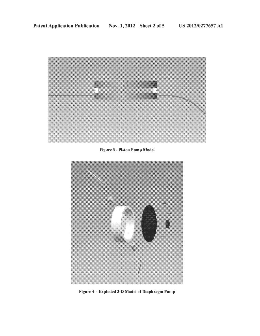 BICORPORAL PARTIALLY SUBCUTANEOUS POSITIVE DISPLACEMENT PUMP - diagram, schematic, and image 03