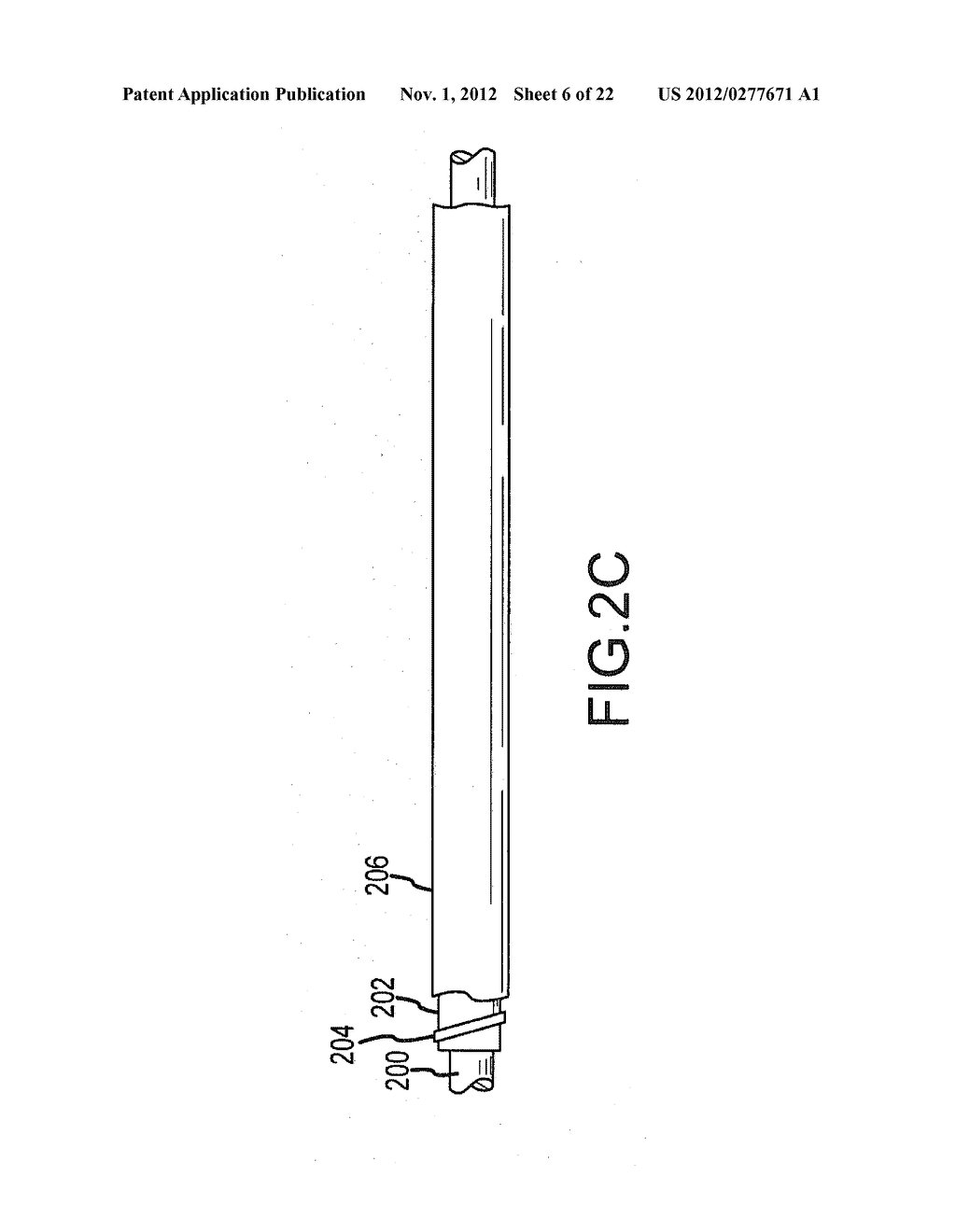 DUAL BRAID REINFORCEMENT DEFLECTABLE DEVICE - diagram, schematic, and image 07