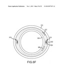 DUAL BRAID REINFORCEMENT DEFLECTABLE DEVICE diagram and image