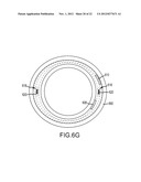 DUAL BRAID REINFORCEMENT DEFLECTABLE DEVICE diagram and image