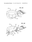 DISSECTION HANDPIECE AND METHOD FOR REDUCING THE APPEARANCE OF CELLULITE diagram and image