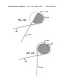 DISSECTION HANDPIECE AND METHOD FOR REDUCING THE APPEARANCE OF CELLULITE diagram and image