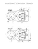 DISSECTION HANDPIECE AND METHOD FOR REDUCING THE APPEARANCE OF CELLULITE diagram and image