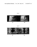 Absorbent Article with Annular Absorbent Member diagram and image