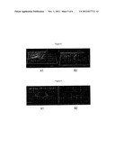 Absorbent Article with Annular Absorbent Member diagram and image