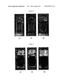 Absorbent Article with Annular Absorbent Member diagram and image