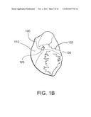 SYSTEMS AND METHODS FOR ENGAGING HEART TISSUE diagram and image