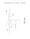 SYSTEMS AND METHODS FOR ENGAGING HEART TISSUE diagram and image