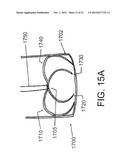 SYSTEMS AND METHODS FOR ENGAGING HEART TISSUE diagram and image