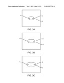 TISSUE ABLATION WITH IRREVERSIBLE ELECTROPORATION diagram and image