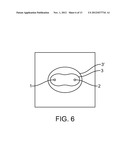 TISSUE ABLATION WITH IRREVERSIBLE ELECTROPORATION diagram and image