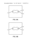 TISSUE ABLATION WITH IRREVERSIBLE ELECTROPORATION diagram and image