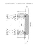 TISSUE ABLATION WITH IRREVERSIBLE ELECTROPORATION diagram and image