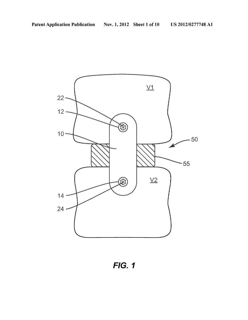 BONE PLATE - diagram, schematic, and image 02