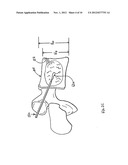 SYSTEMS AND METHODS FOR VERTEBRAL OR OTHER BONE STRUCTURE HEIGHT     RESTORATION AND STABILIZATION diagram and image