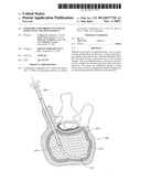 STEERABLE VERTEBROPLASTY SYSTEM WITH CAVITY CREATION ELEMENT diagram and image