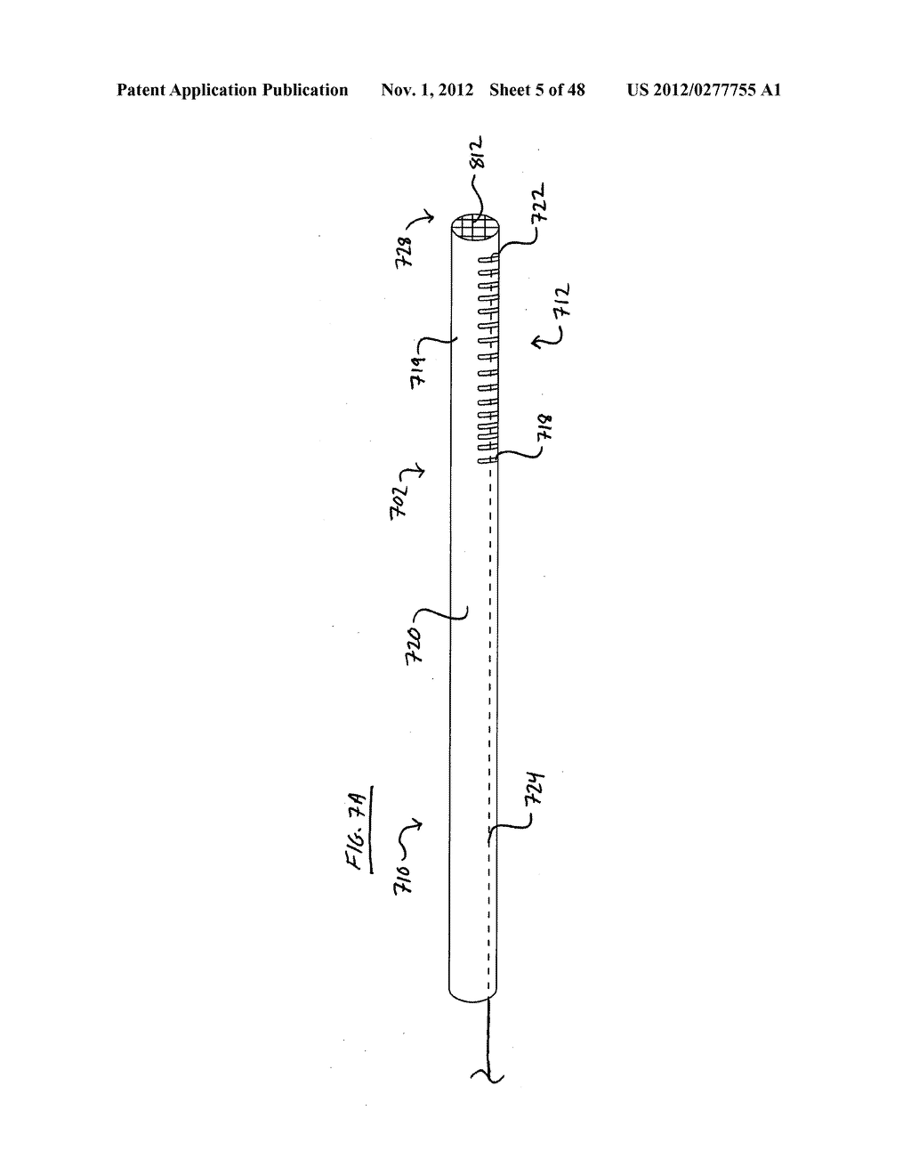 STEERABLE VERTEBROPLASTY SYSTEM WITH CAVITY CREATION ELEMENT - diagram, schematic, and image 06