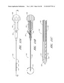 STEERABLE VERTEBROPLASTY SYSTEM WITH CAVITY CREATION ELEMENT diagram and image