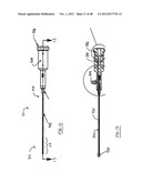 STEERABLE VERTEBROPLASTY SYSTEM WITH CAVITY CREATION ELEMENT diagram and image