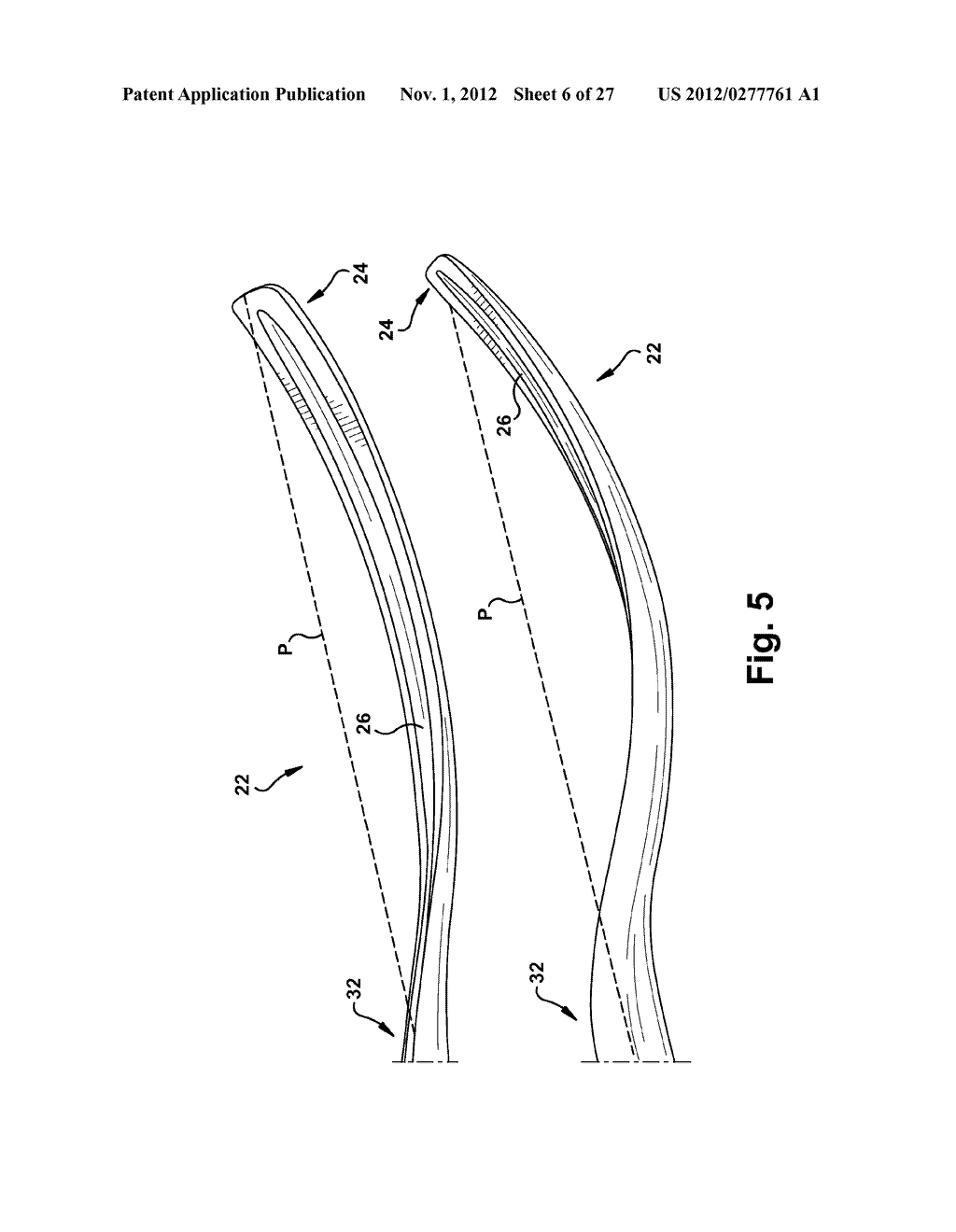 SURGICAL TOOLS TO FACILITATE DELIVERY OF A NEUROSTIMULATOR INTO THE     PTERYGOPALATINE FOSSA - diagram, schematic, and image 07