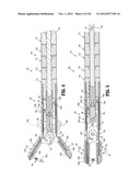 Flexible Endoscopic Stitching Devices diagram and image