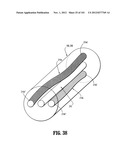 Flexible Endoscopic Stitching Devices diagram and image