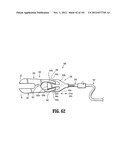 Flexible Endoscopic Stitching Devices diagram and image