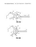 Flexible Endoscopic Stitching Devices diagram and image