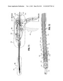 Flexible Endoscopic Stitching Devices diagram and image