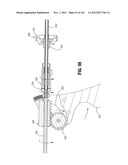 Flexible Endoscopic Stitching Devices diagram and image