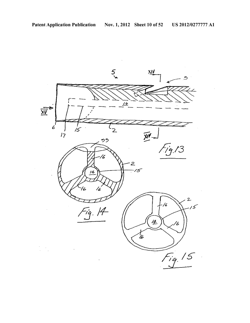 Vein stripping device - diagram, schematic, and image 11