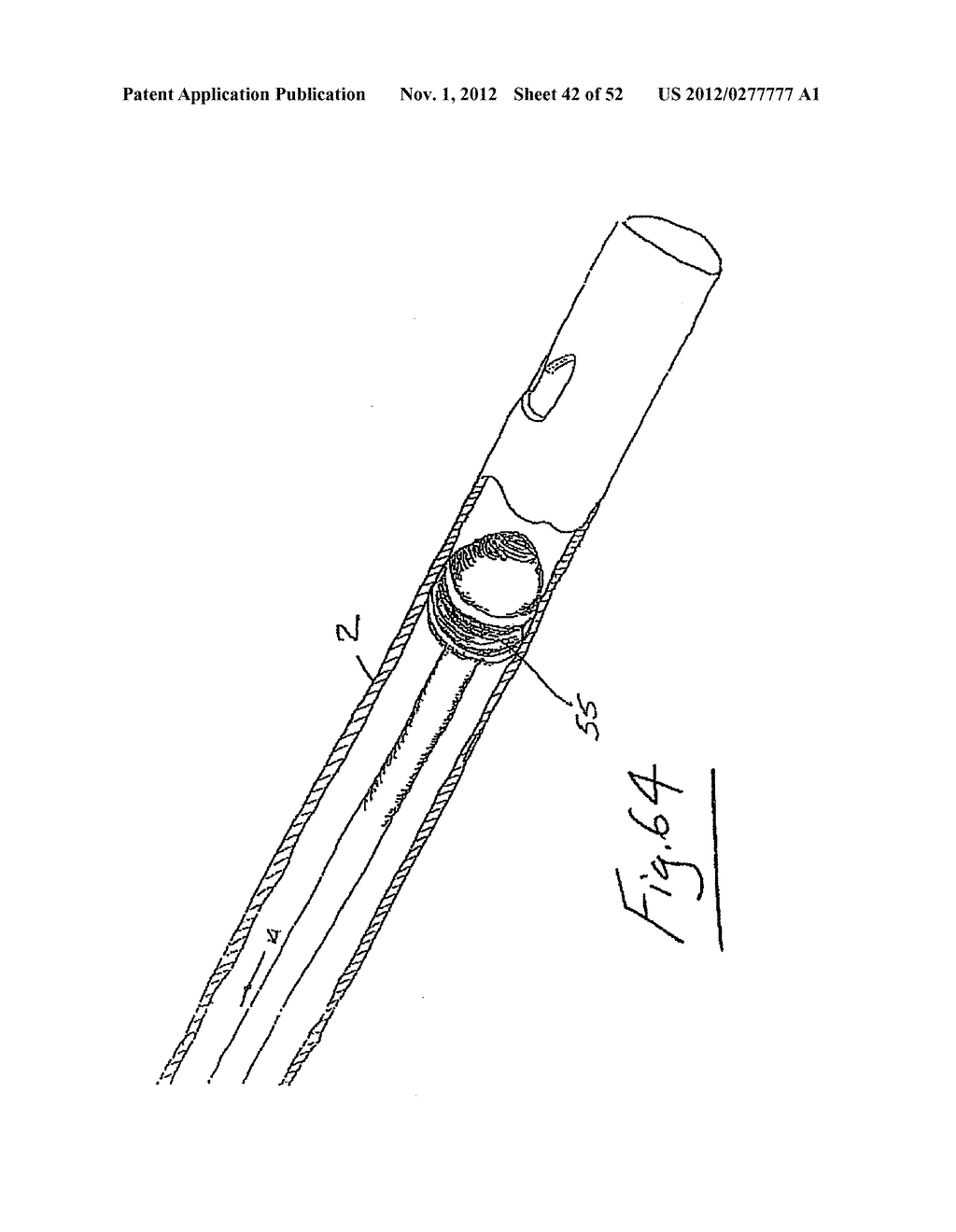 Vein stripping device - diagram, schematic, and image 43