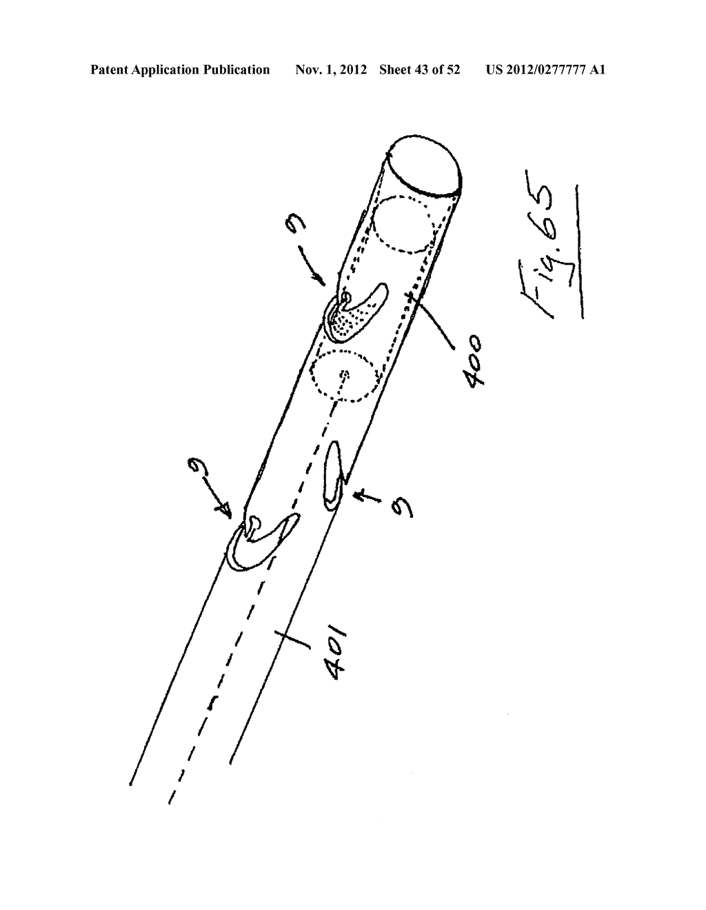 Vein stripping device - diagram, schematic, and image 44