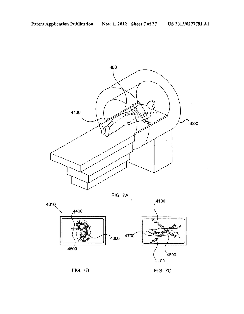 METHODS AND DEVICES TO MODULATE THE AUTONOMIC NERVOUS SYSTEM WITH     ULTRASOUND - diagram, schematic, and image 08