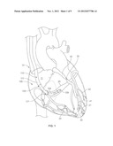 Treating Heart Tissue diagram and image