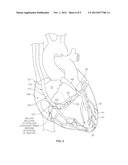 Treating Heart Tissue diagram and image