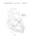 Treating Heart Tissue diagram and image