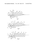 MEDICAL DEVICE FOR INSERTION INTO A HOLLOW ORGAN AND METHOD FOR PRODUCING     SUCH A DEVICE diagram and image