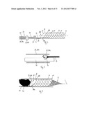 MEDICAL DEVICE FOR INSERTION INTO A HOLLOW ORGAN AND METHOD FOR PRODUCING     SUCH A DEVICE diagram and image