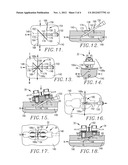 VASCULAR WOUND CLOSING APPARATUS AND METHOD diagram and image